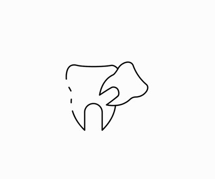 Удаление зубов Дента-Лаб